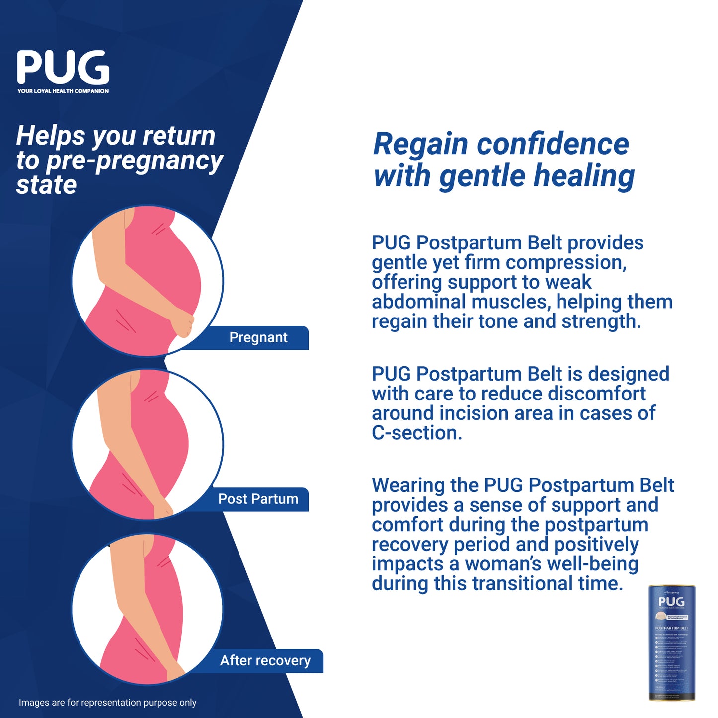 PUG Postpartum Belt, Universal size, Beige, Ergonomically designed for Indian Mothers, For C-Section and Natural Delivery, Eliminates post pregnancy pain, Muscle recovery to pre-pregnancy state